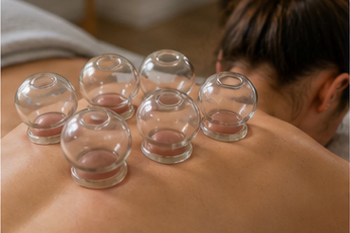 Glass cups arranged for cupping therapy in Perth